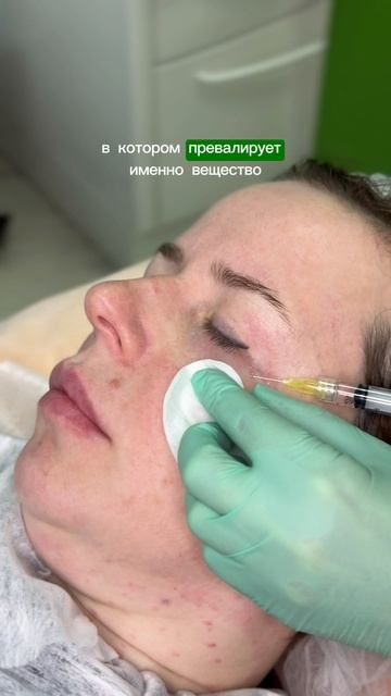 Коррекция морщин вокруг глаз