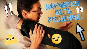 Как убрать варикоз и боль в ногах?