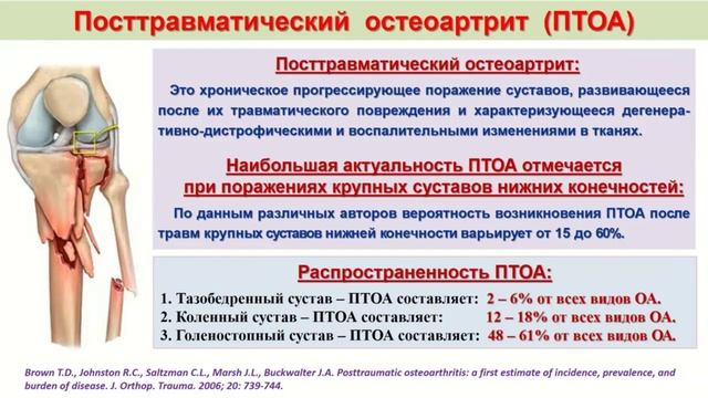 Современные подходы к комплексному лечению пациентов с переломами плато большеберцовой кости. смотреть онлайн