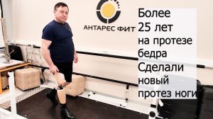 Более 25 лет на протезе бедра. Сделали новый протез ноги.