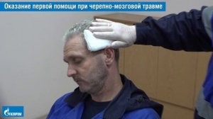 22. Оказание первой помощи при черепно-мозговой травме и при подозрении на перелом позвоночника