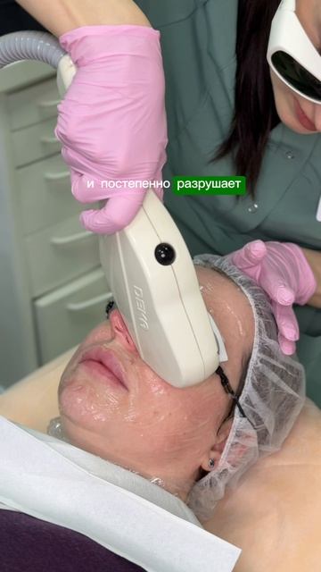 Фотоомоложение лица и шеи