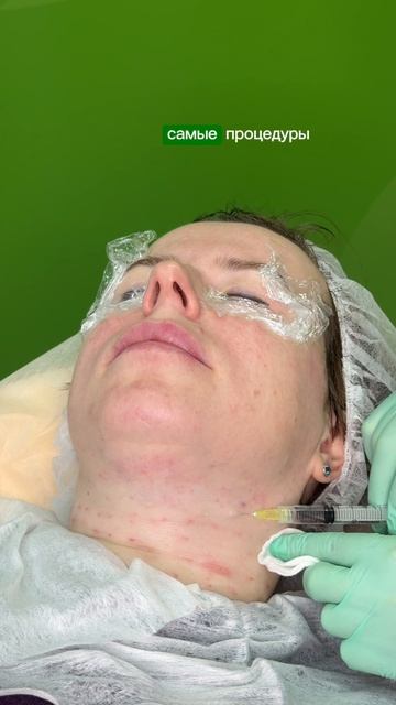 Процедуры против старения кожи шеи и кистей рук