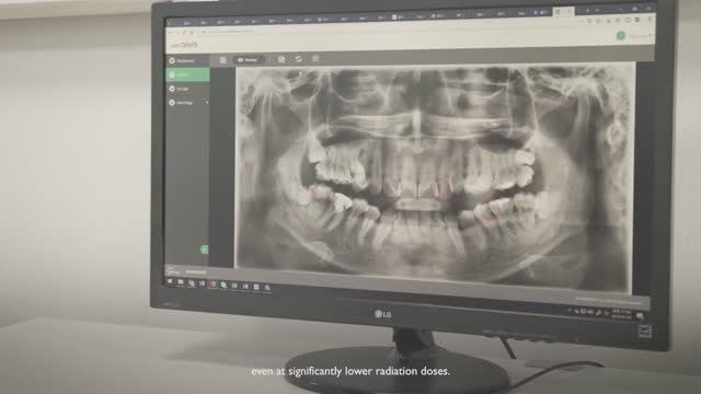 The Science of Low Dose — Vatech CBCT Proven Results смотреть онлайн