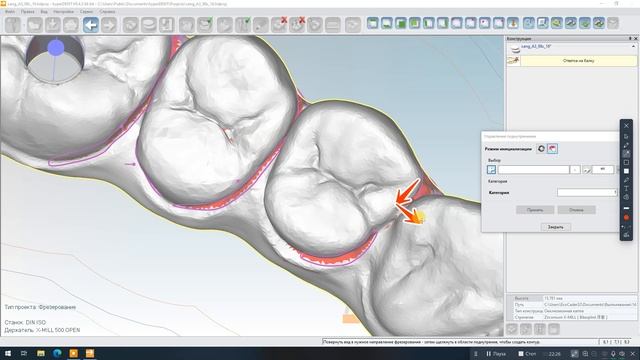 Ответка на балку HyperDent смотреть онлайн