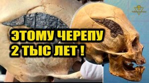 Древний череп с металической вставкой которому 2000 лет