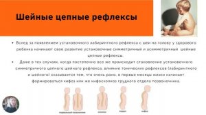 Как формируются патологические установки у детей с ДЦП Влияние патологических рефлексов