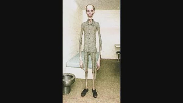 МЕДИЦИНСКИЙ ЭКСПЕРИМЕНТ. "Записи об аномалиях от К.О.Н.Т.У.Р." №80, ЗАПИСЬ 057.