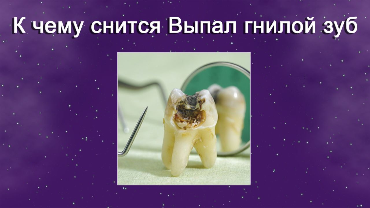К чему снится Выпал гнилой зуб (Сонник)