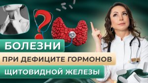 Болезни при дефиците гормонов щитовидной железы.