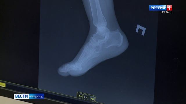 За неделю около 500 рязанцев обратились за помощью в травмпункт БСМП смотреть онлайн