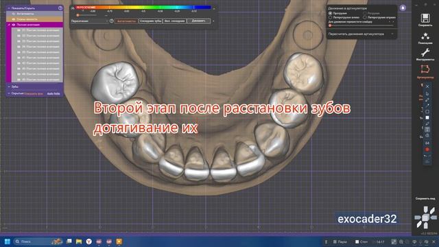 Мокап 35-45 ExoCad смотреть онлайн