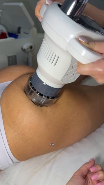 новый тренд сезона, процедура Magic Shape. А вы уже пробовали?