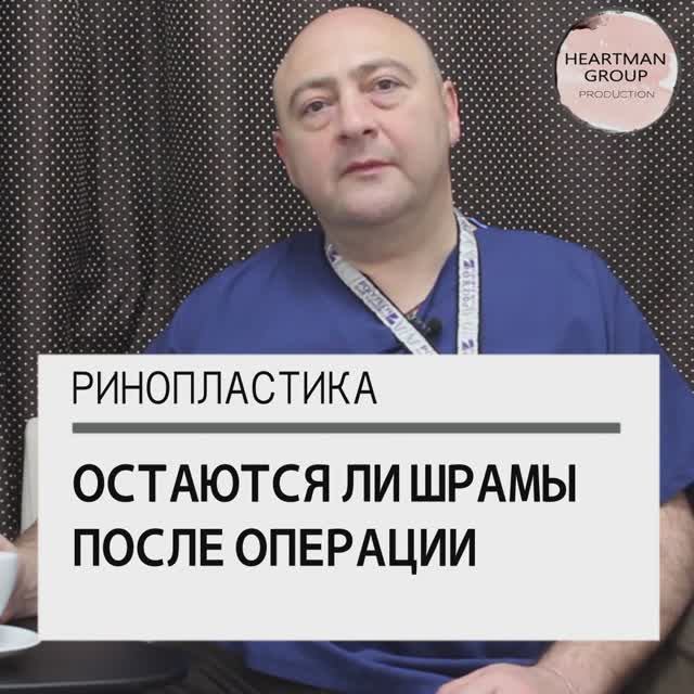 Шрамы при ринопластике, Пластический хирург Меладзе Зураб, Москва