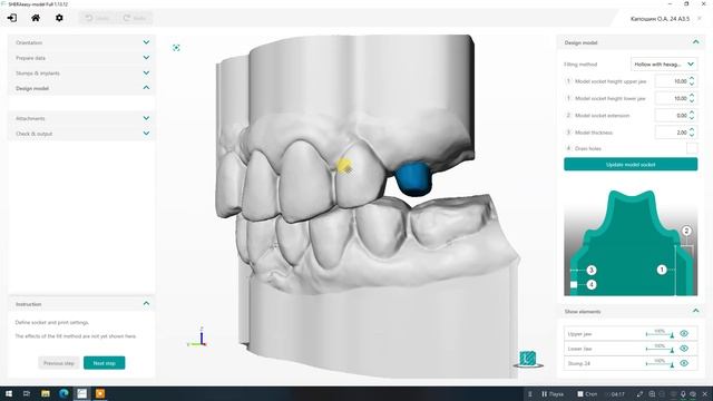 2) Shera Eady Model - Штампик на один зуб смотреть онлайн