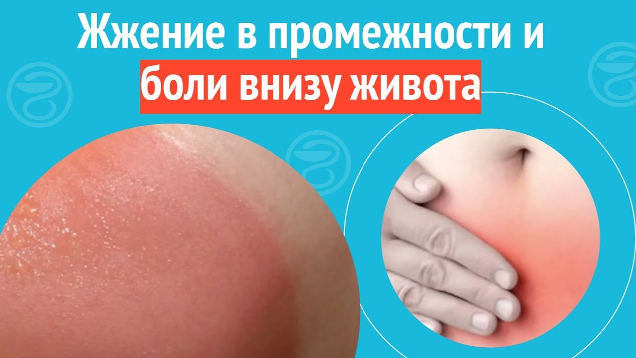 😰 Жжение в промежности и боли внизу живота. Клинический случай №1509 смотреть онлайн