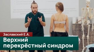 Верхний перекрёстный синдром: причины и следствия. Заславский Е.А.