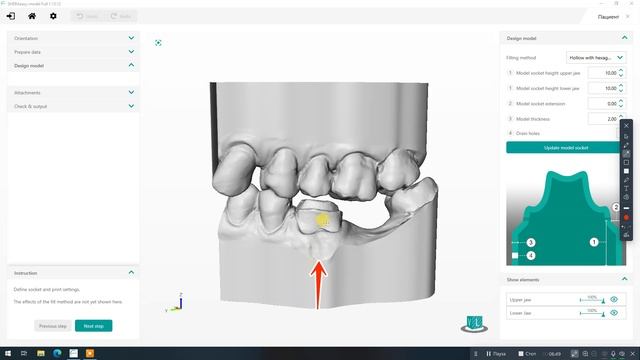 1) Shera Eady Model - накладка на зуб смотреть онлайн