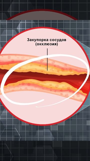 Причина старения - закупорка сосудов.