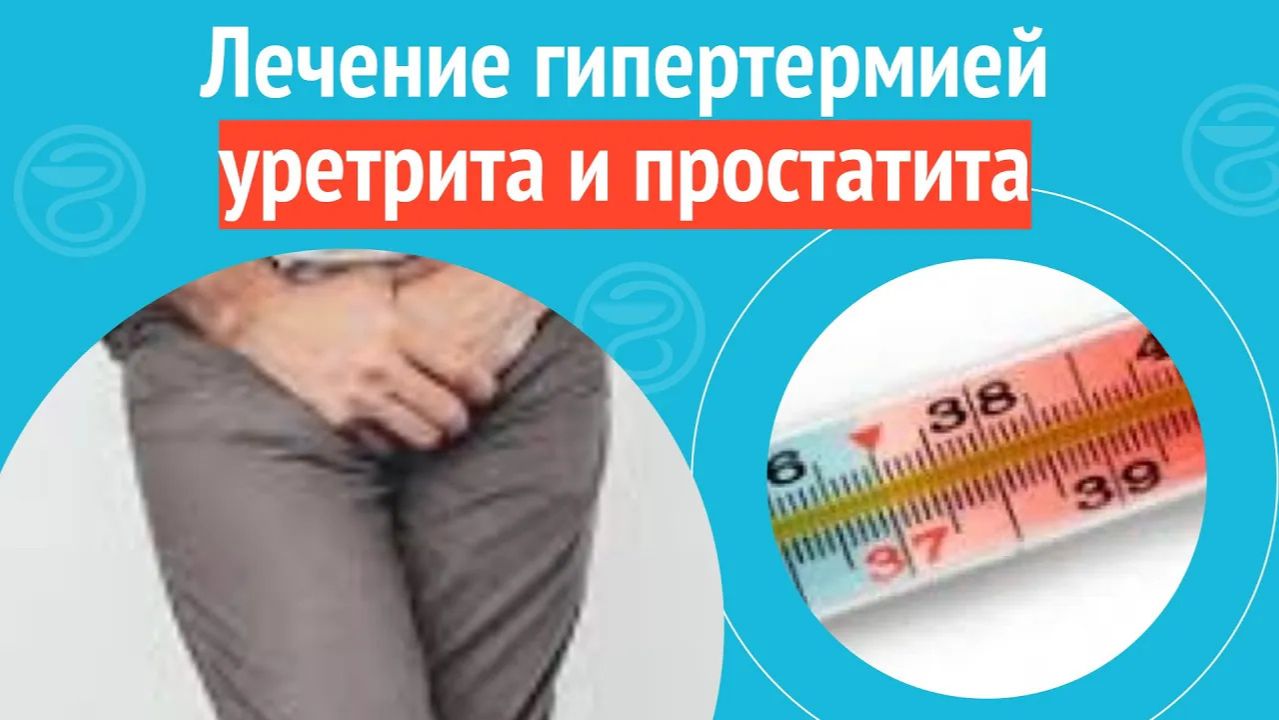 ✅ Лечение гипертермией уретрита и простатита. Клинический случай №1505 смотреть онлайн