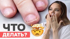 Самые сложные ногти для мастеров | Наращивание на обгрызенные