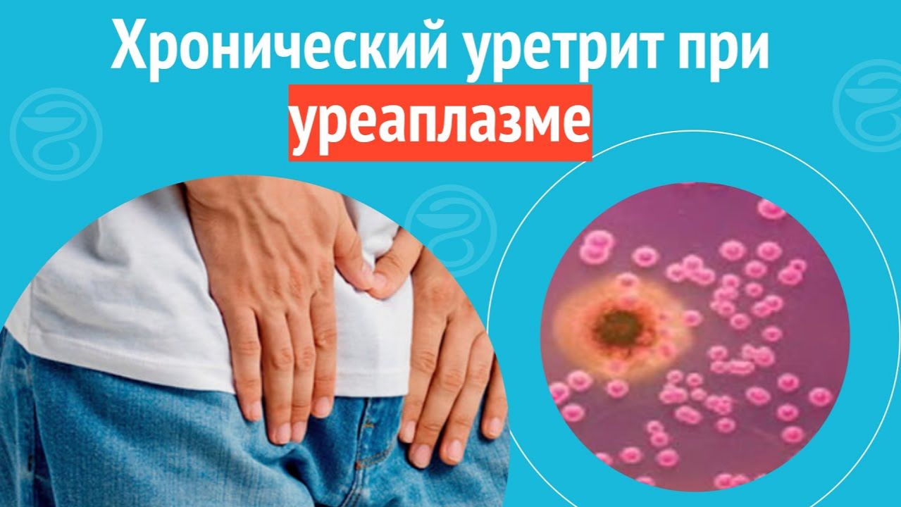 😨 Хронический уретрит при уреаплазме, гарднерелле и энтерококке. Клинический случай №1468 смотреть онлайн