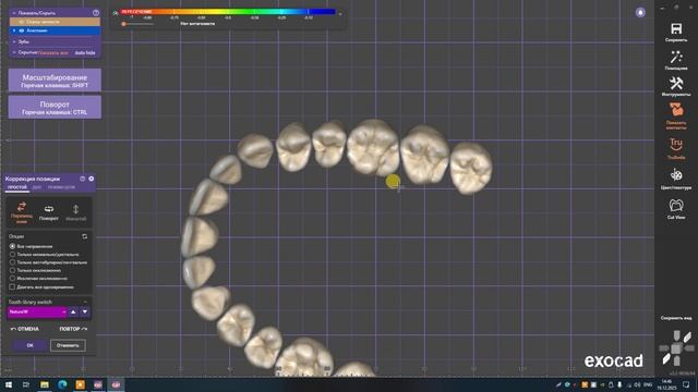 5) Toothe Model Editor - подключаем библиотеку в ExoCad смотреть онлайн