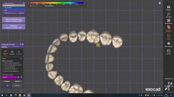 5) Toothe Model Editor - подключаем библиотеку в ExoCad