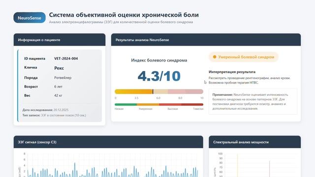NeuroSense смотреть онлайн
