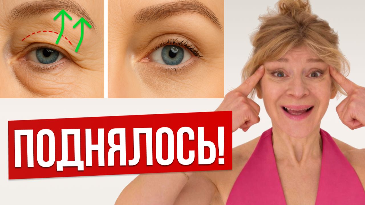 Веки ПОДНЯЛИСЬ БЕЗ ОПЕРАЦИИ за 10 минут! Блефаропластика дома смотреть онлайн