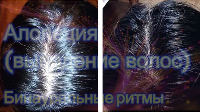 Алопеция (выпадение волос)*Бинауральные ритмы*Частота Райфа*Отрастите волосы смотреть онлайн