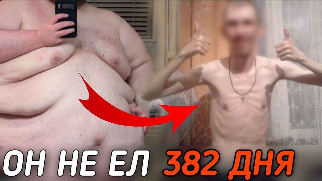 Шокирующая история Ангуса, человека не евшего больше года.. смотреть онлайн