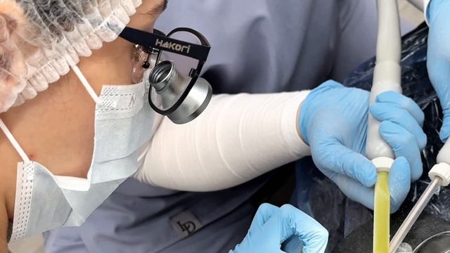 Профессиональная гигиена полости рта💫
Врач стоматолог-гигиенист Ибрагимова Диана Сакитовна🦷