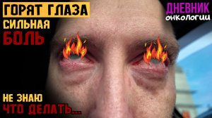 Обострение. Сильно горят глаза. Что делать не знаю. Сильная боль. Жизнь в диагнозе. Рак крови. Онко