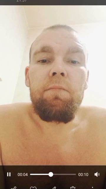 перед и после реанимации. глпс