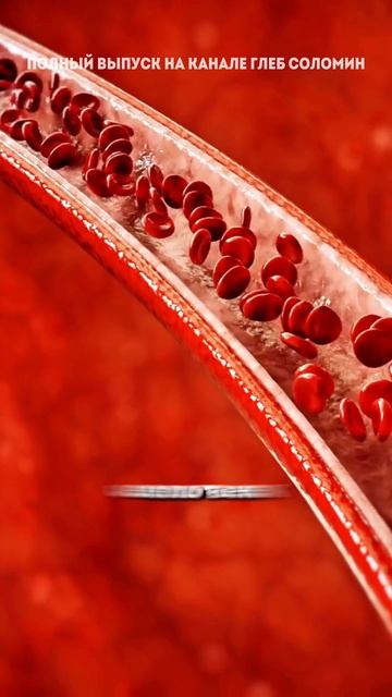 Что повреждает сосуды смотреть онлайн