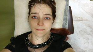 Акупунктурный лифтинг лица. Что за зверь? Что за процедура. Сейчас расскажу и покажу