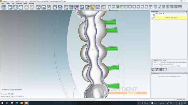 Фрезеруем HybridBar в HyperDent смотреть онлайн