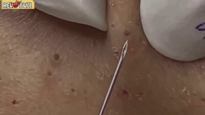 Глубокое очищение кожи. Успокаивающая косметическая процедура для снятия стресса #𝟗𝟎𝟎𝟑𝟔𝟏