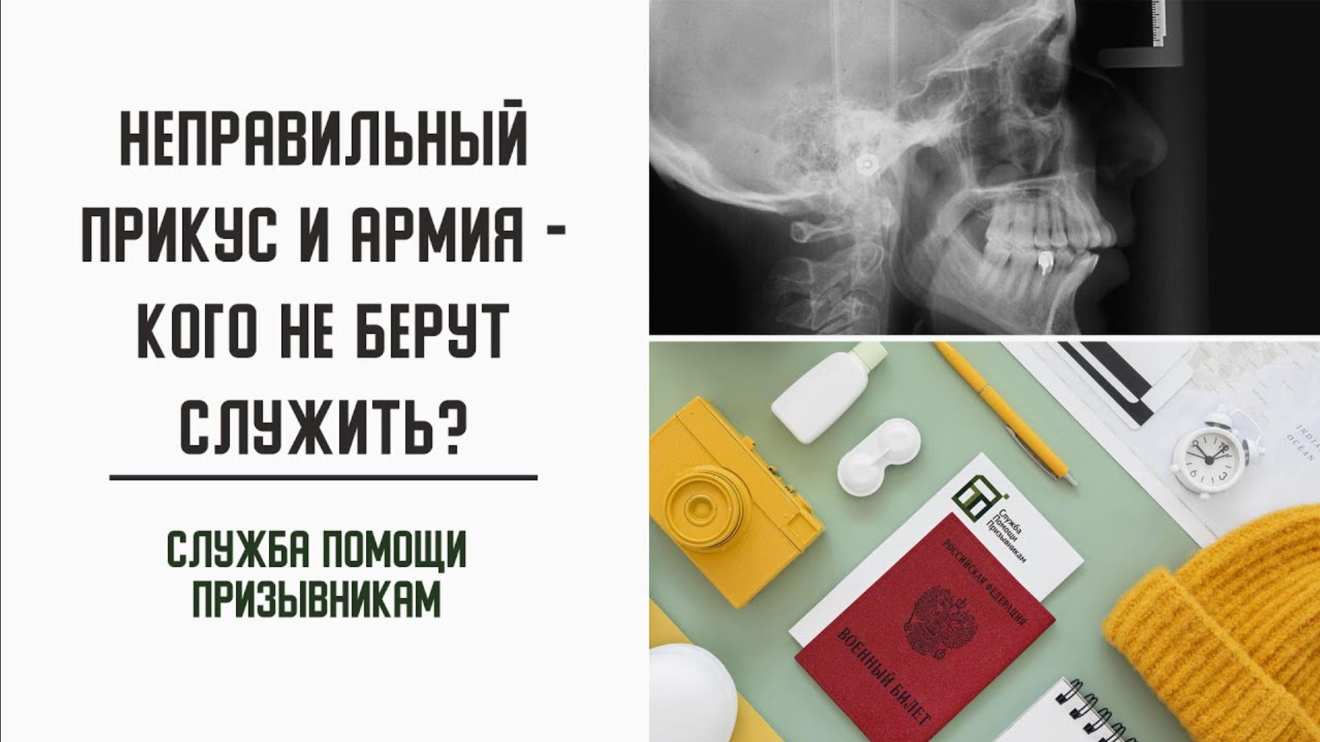 Берут ли в армию с неправильным прикусом? смотреть онлайн