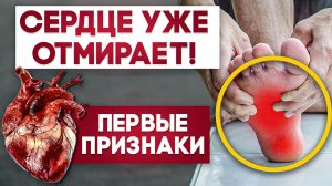 ЭТИ симптомы укажут на ЗАБИТЫЕ СОСУДЫ! / Из-за чего возникает тяжесть в ногах?