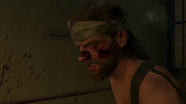 Metal gear Solid V. Прохождение. Часть 1