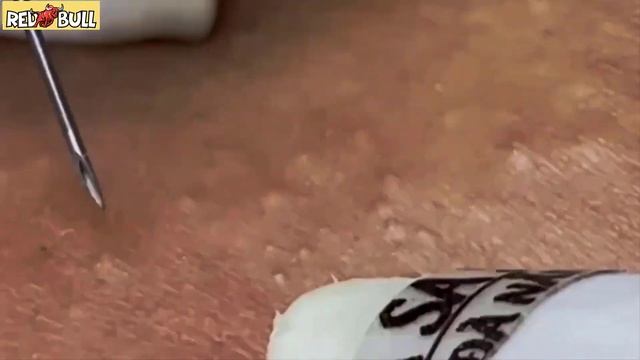 Глубокое очищение кожи. Успокаивающая косметическая процедура для снятия стресса #𝟗𝟎𝟎𝟑𝟓𝟗 смотреть онлайн