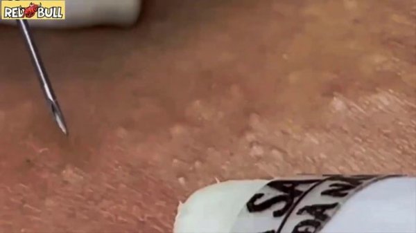 Глубокое очищение кожи. Успокаивающая косметическая процедура для снятия стресса #𝟗𝟎𝟎𝟑𝟓𝟗