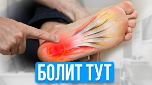 3 Простых Упражнения УБЕРУТ Боль в Пятке НАВСЕГДА! Делай по 1 минуте в ДЕНЬ!