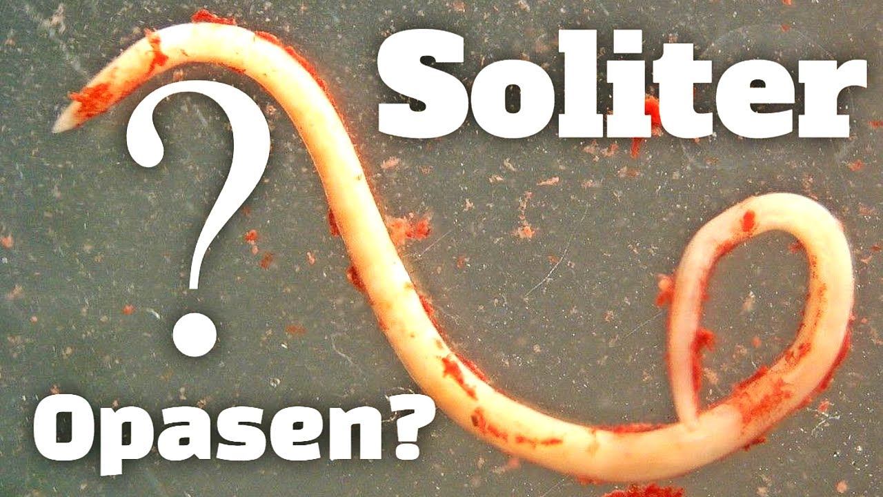 Опасно ли для здоровья есть рыбу с солитером? Что будет с печенью и другими органами?! смотреть онлайн