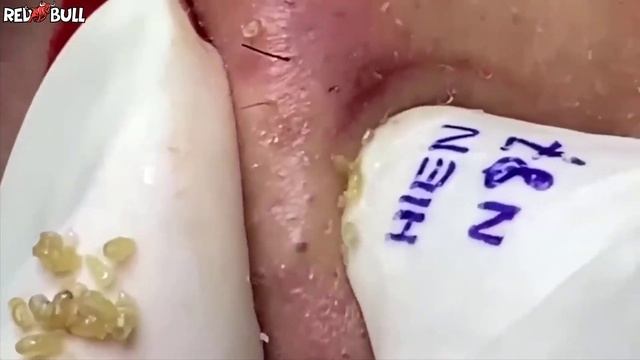 Глубокое очищение кожи. Успокаивающая косметическая процедура для снятия стресса #𝟗𝟎𝟎𝟑𝟕𝟎 смотреть онлайн