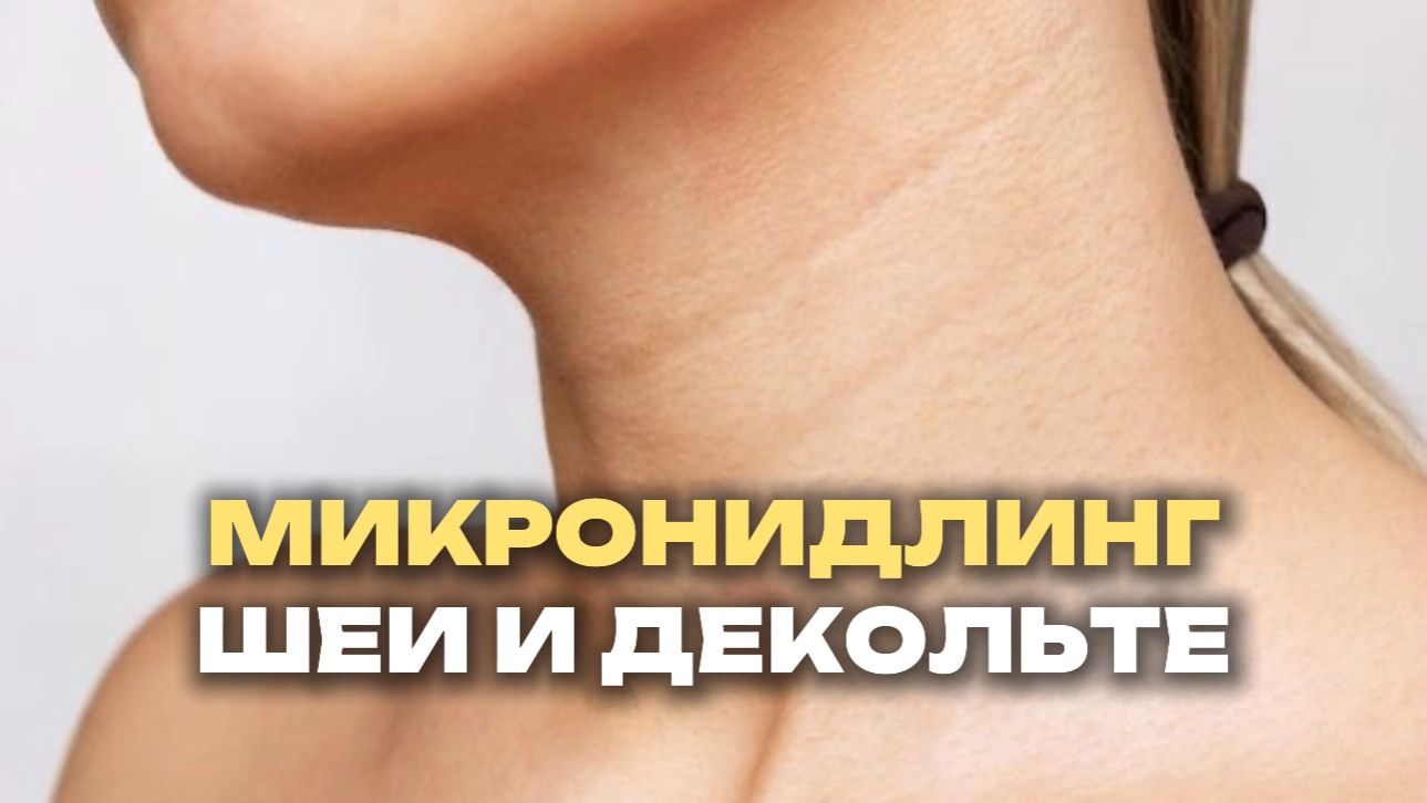 Микронидлинг шеи и декольте: как избавиться от морщин на шее смотреть онлайн