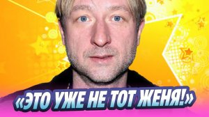 У Плющенко осложнения после блефаропластики 🔥 Новости Шоу-Бизнеса