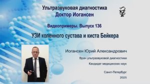 УЗИ. Доктор Иогансен. Видеопримеры. Выпуск 136. УЗИ коленного сустава и киста Бейкера.